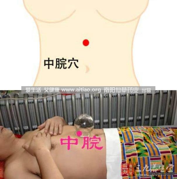 中脘穴位于腹部正中线，脐上4寸的位置上。每天艾灸10-15分钟，能有效缓解胃部不适的症状，同时有助于祛湿。